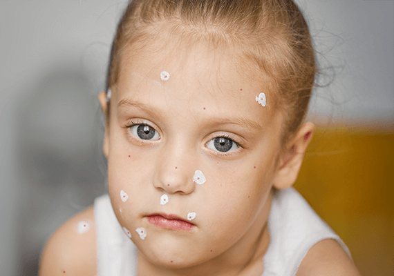 Skin Conditions
